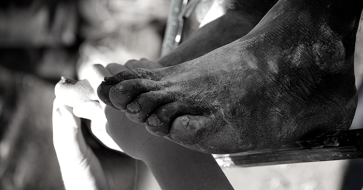 Royal Commission - many Anangu with a disability have never told their story or reached out for help before